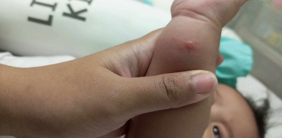 Ano po kaya tumubo sa kamay at legs ng LO ko?