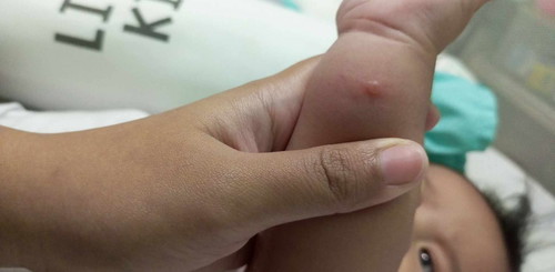 Ano po kaya tumubo sa kamay at legs ng LO ko?