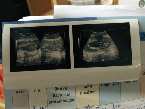 ท๊าาาดา.. ??ดีใจมากจ้าได้ลูกสาว