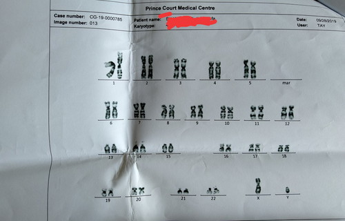 result amnio..lupa nk upload