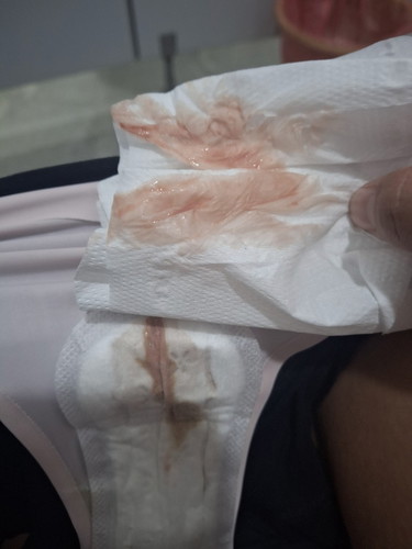 32+6 Week มีมูกเลือดออกแบบนี้เสี่ยงคลอดก่อนกำหนดไหมคะ