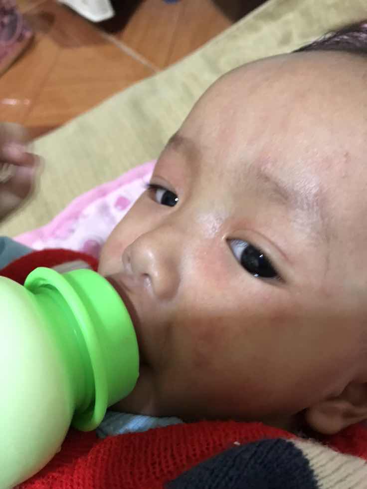 เป็นพื้นแดง