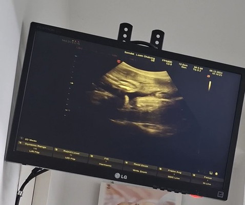 น้องจะไม่ย้ายทีมใช่มั้ยคะ ?