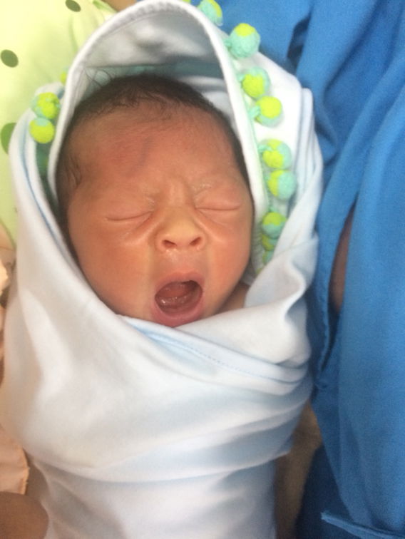 น้ำเดินก่อนกำหนดคลอด