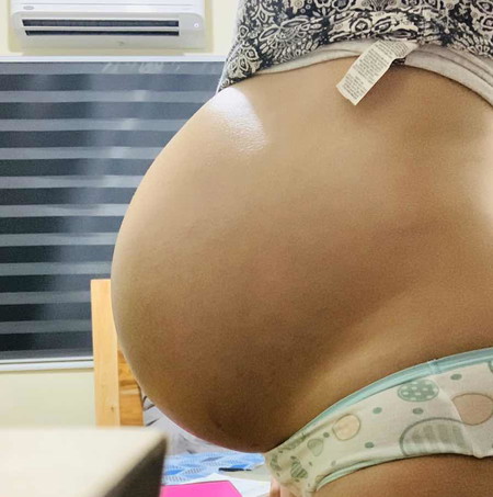 Belly