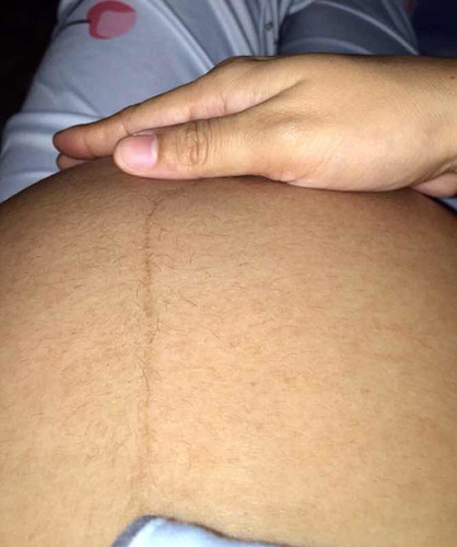 Contraction feels. Braxton hicks or active labor?