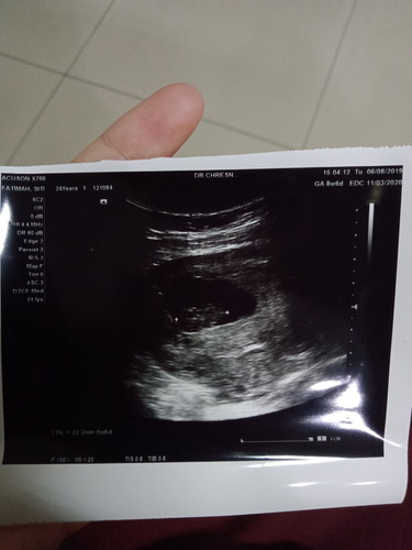hasil Usg