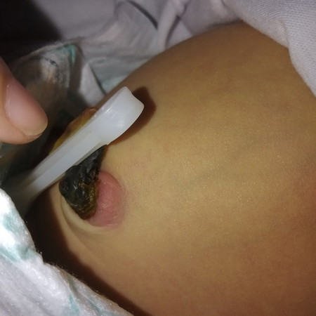 Umbilical Cord