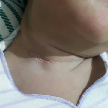 bayi 3 bulan