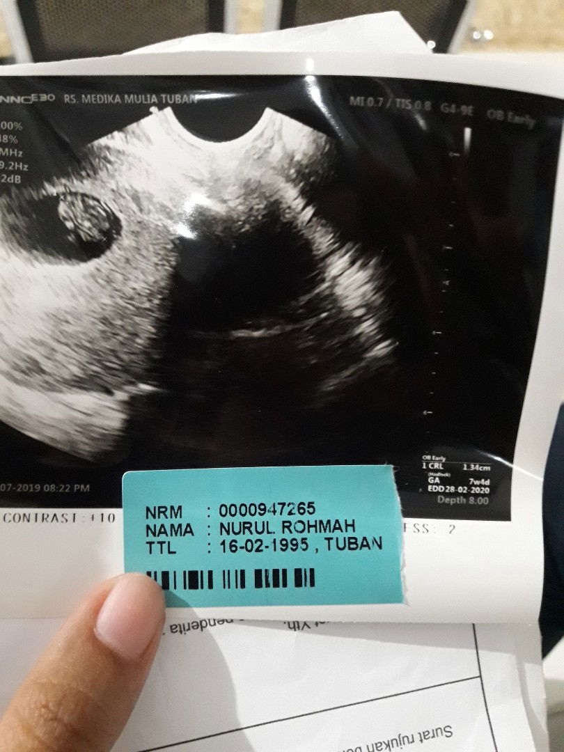 flek dan belum terdengar denyut jantung