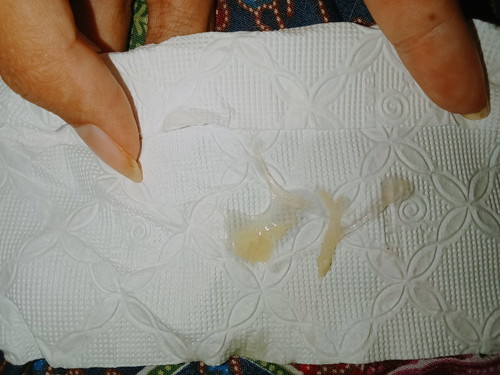 ใช่ตกขาวไหมคะ