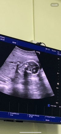 wantana yodhom profile icon