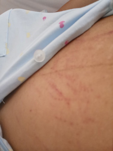 After Delivery