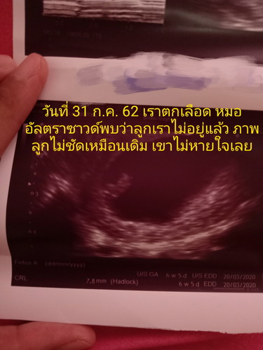 ลูกไม่อยู่กับเราแล้ว