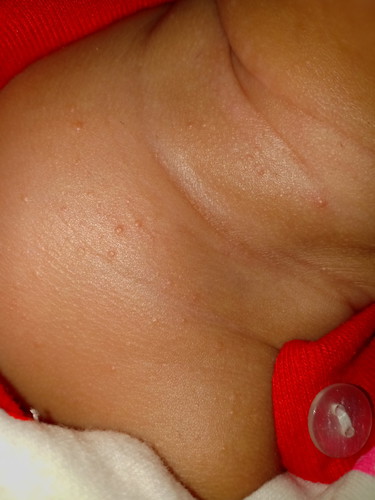bayi