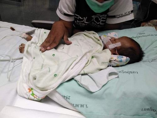 ขอประสบการณ์ลูกใส่ทอช่วยหายใจ