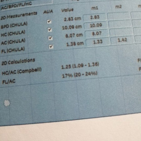 ไม่เข้าใจความหมาย??