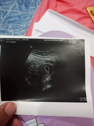 ปกติไหมค่ะ??