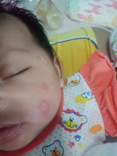 น้องๆเคยเป็นแบบนี้ไหมค่ะ??