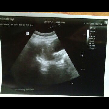 Alhamdulillah kehamilan pertama saya