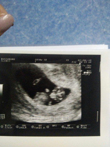 มุมคุณแม่