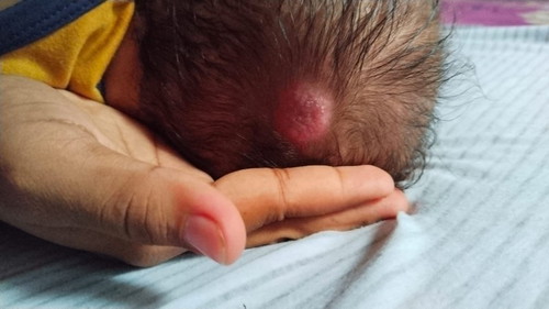 Assalamualaikum bunda²