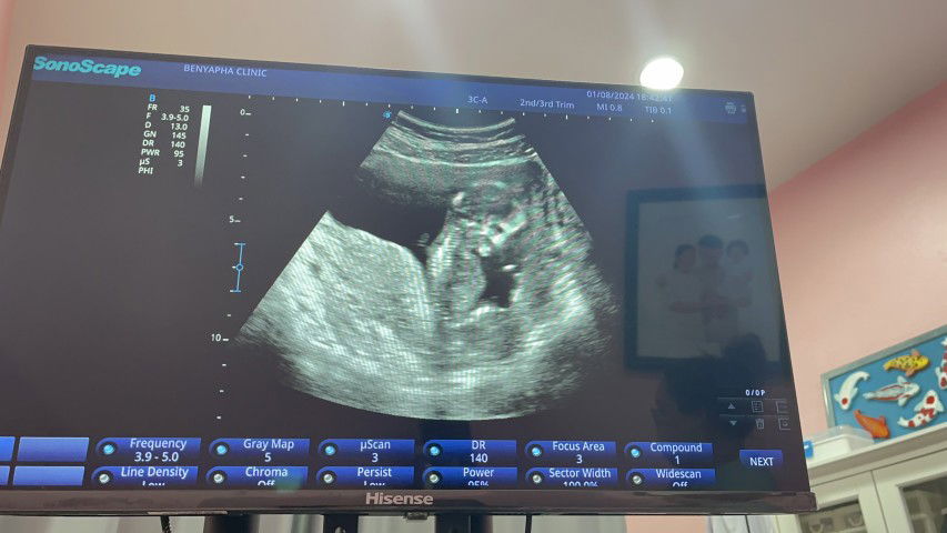 bbbimild profile icon