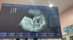 bbbimild profile icon
