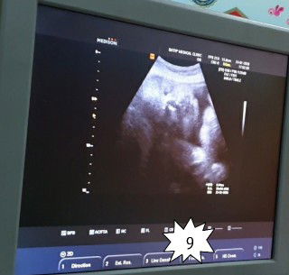 ฝัน profile icon