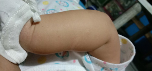skin rashes