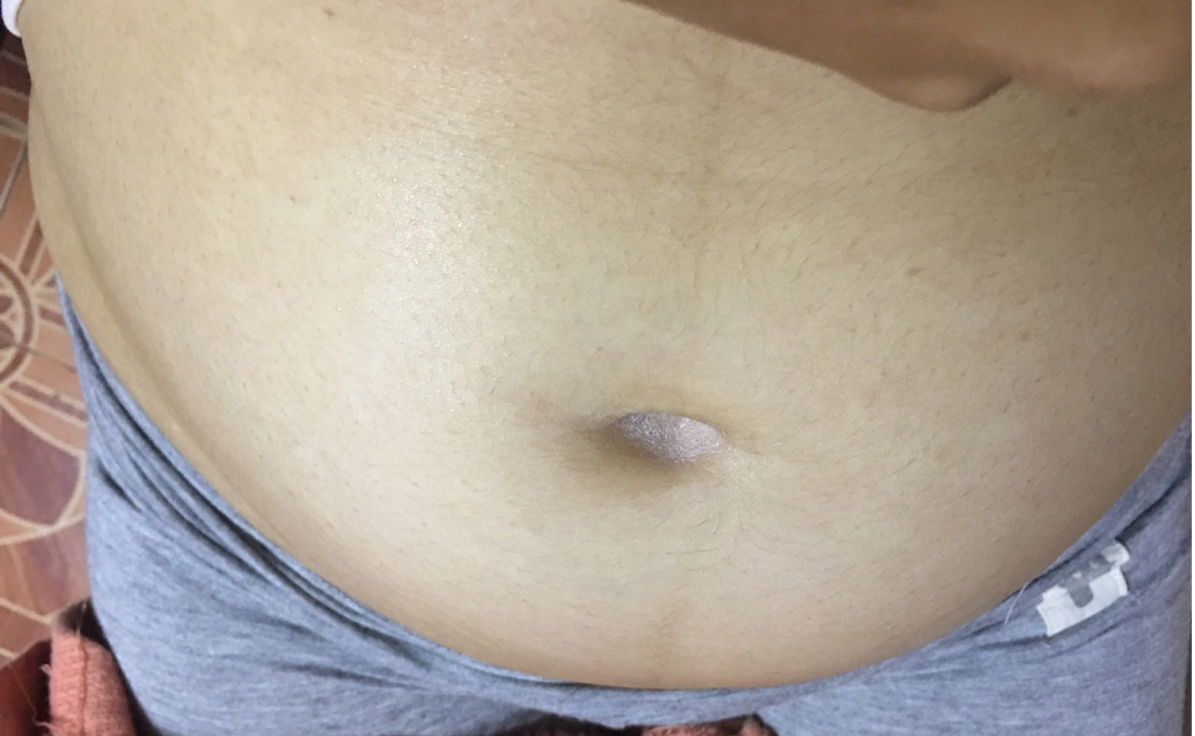 ท้องแบบนี้ผู้หญิงผู้ชายคะ