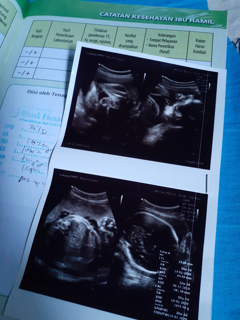 Bingung sama gambar hasil usgnya ?