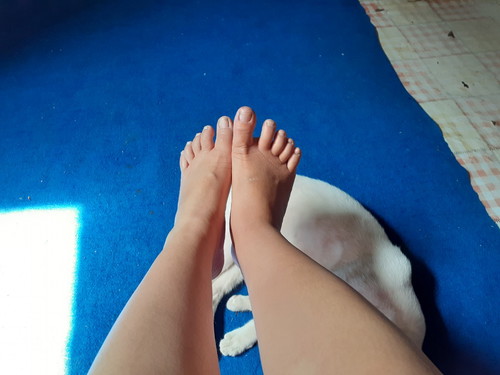 Kaki bengkak