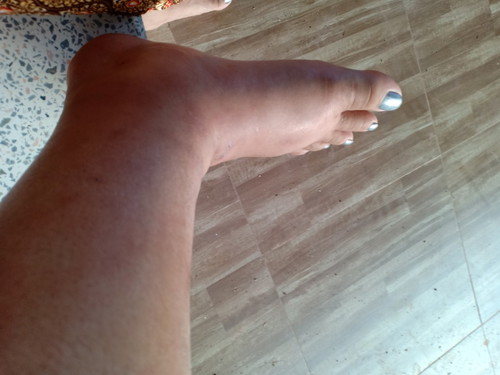 แชร์ประสบการณ์ตัวต่อต่อย