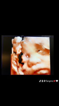 กรรณิการ์ จุลฬา profile icon