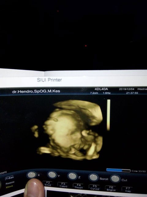 Yuni Wahyuni profile icon