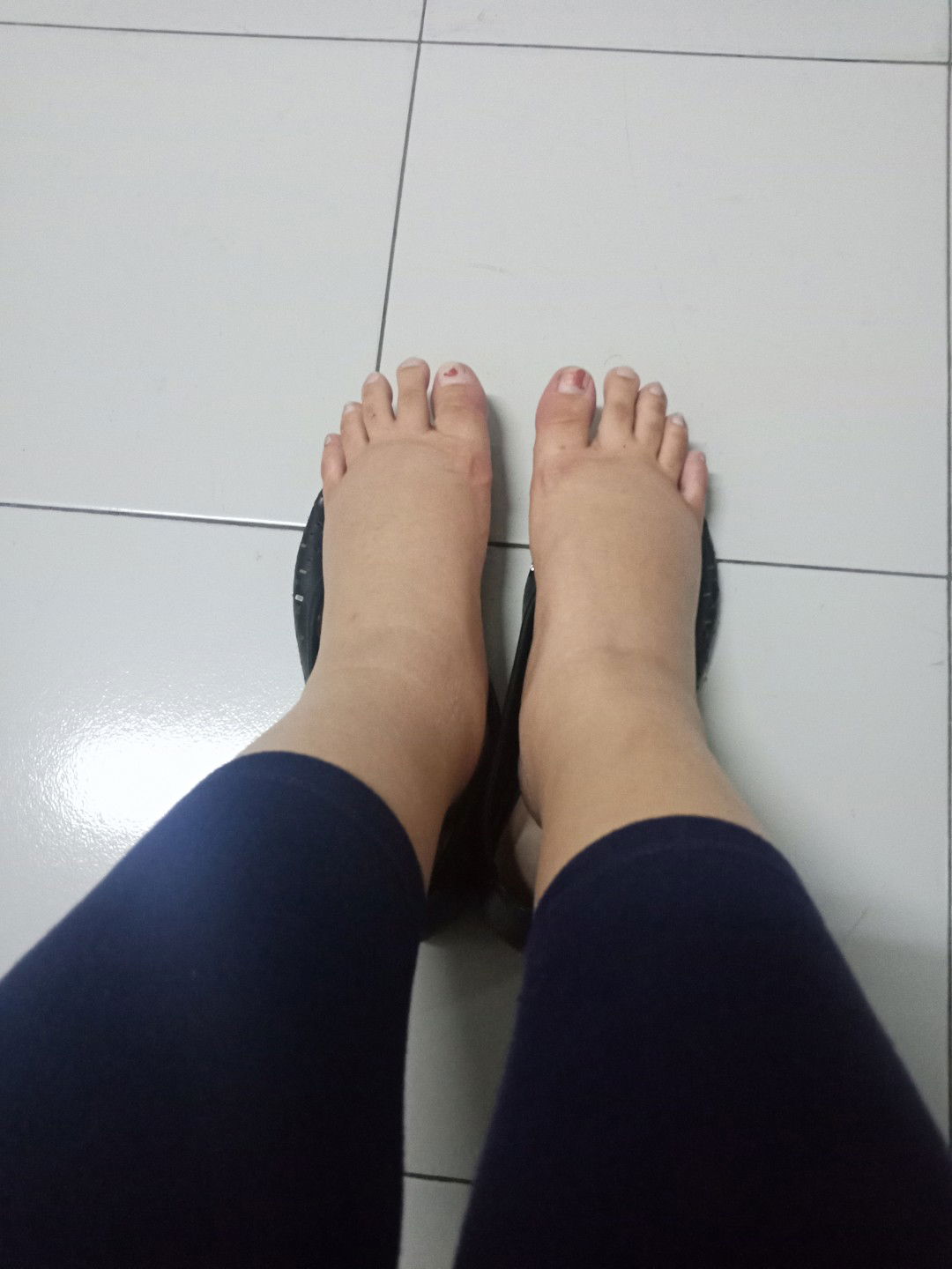 kaki bengkak di usia kandungan 8 bulan