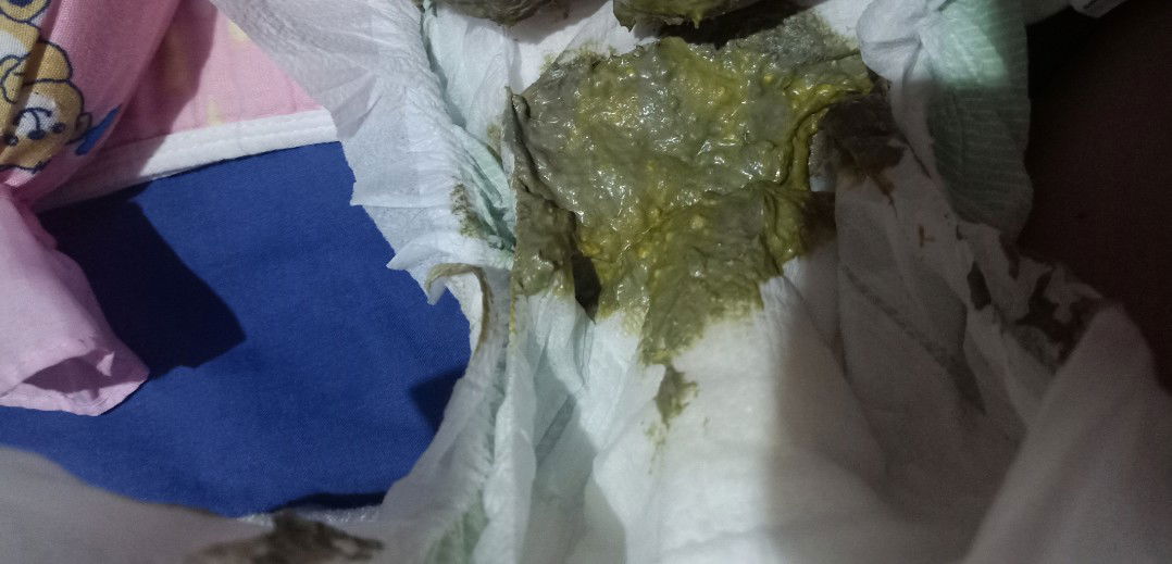 Color Ng Poop Ni Baby.