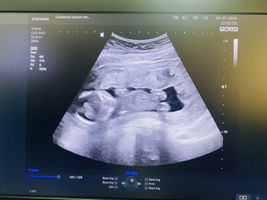 BaiFern profile icon