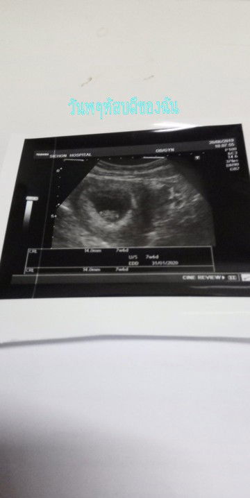 4ปีแห่งการรอค่อย หนูน้อย??