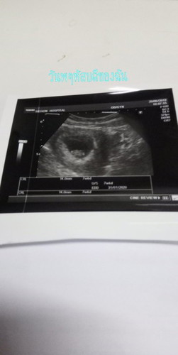 4ปีแห่งการรอค่อย หนูน้อย??