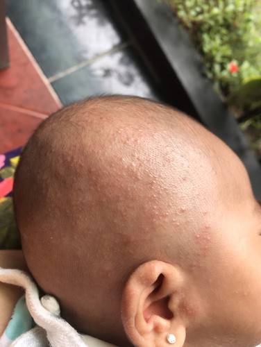 Bintik merah dikepala