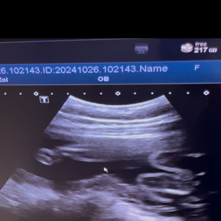 ช่วยดูให้หน่อยค่ะแม่ลูกสาวหรือลูกชายค่ะ