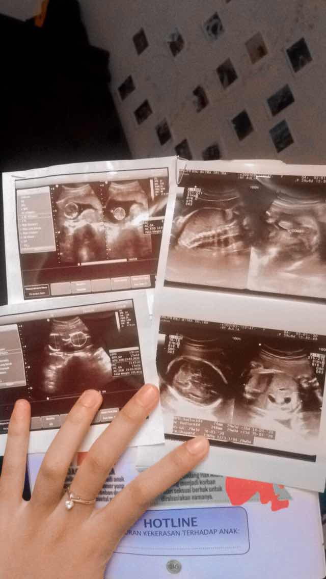 Aulia asyah profile icon