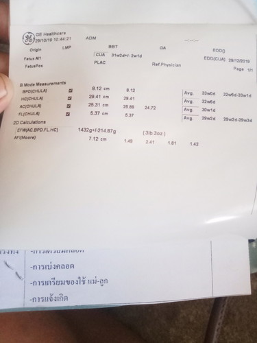 อายุ29w2d