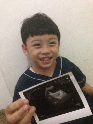 Hamil anak kedua, insyaAllah ?