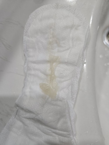 30weeks + 1 day: Is this mucus plug?