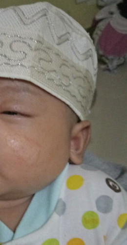 Pipi