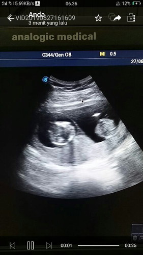 sex selama hamil kembar bahaya atau tidak..?