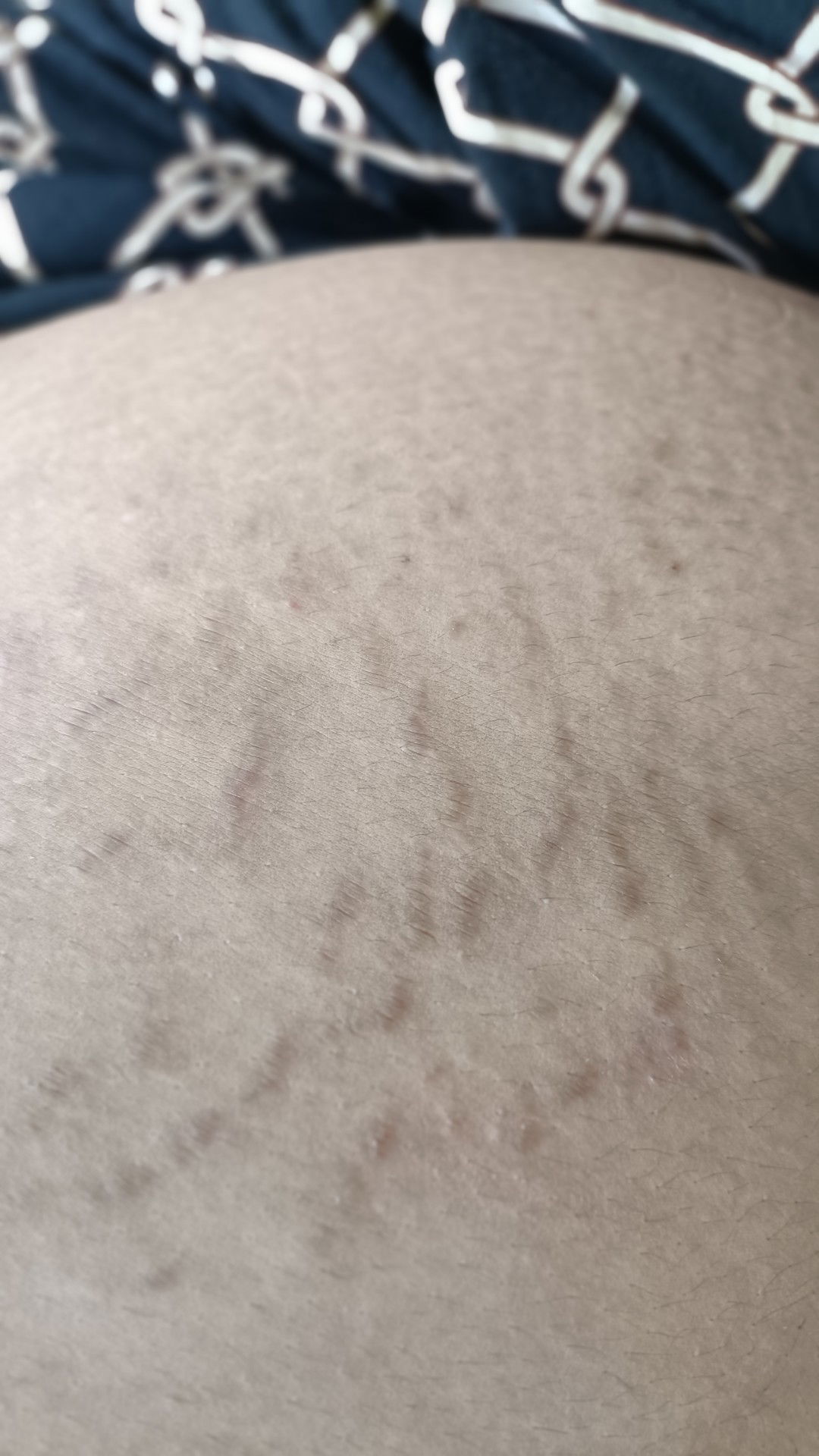 บ้านไหนเป็นกันไหมคะ